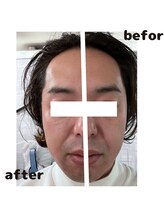 美バリ 新宿店(美BARI)/男性の方も◎