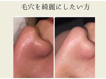 BUB 立川/毛穴を綺麗にしたい方へ