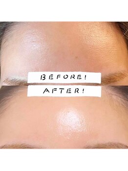 レプス(Lepus)/水光生美容液ピーリング