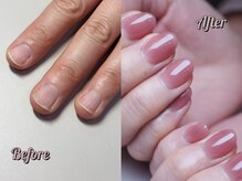 パズルリングネイル(Puzzle.ring Nail)/深爪スカルプー￥19800