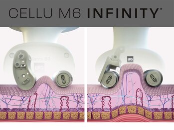 ビューティーリバース センター北店/エンダモロジーインフィニティ