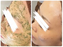 カピリナ(ka pilina)/～ざらつき・くすみ解消～