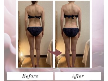 トータルビューティー筋膜ケアサロン カンスタイル(Kanstyle)/姿勢改善