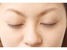 コージープレイスアイビューティー(Cozy Place eye beauty)/before