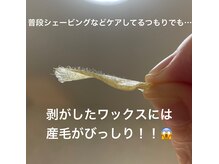 シャリテ(Charite)/うぶ毛がびっしり！！！