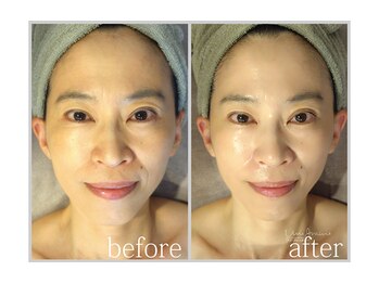 アン グレーヌ 自由が丘(unegraine)/パッと見た目の印象が変わります