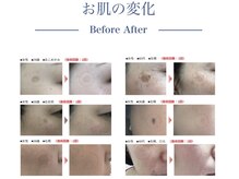 クリニカルホワイトケア 和泉府中店(クリニカルWHITEケア)/ビフォーアフター