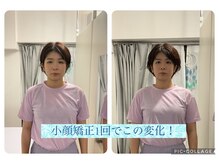 オスベル(OSBELLE)の雰囲気（頭蓋骨小顔矯正では首や肩のコリもほぐし根本からの歪みを改善！）