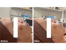 シズク ビューティーサロン(SHIZUKU beauty salon )/