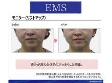 ラヴィニティ 池袋(Lavinity)/EMS