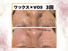 ウェリナポノビューティサロン(welina pono beauty salon)/《小顔/毛穴/脱毛》