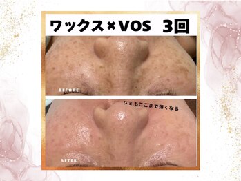 ウェリナポノビューティサロン(welina pono beauty salon)/《小顔/毛穴/脱毛》