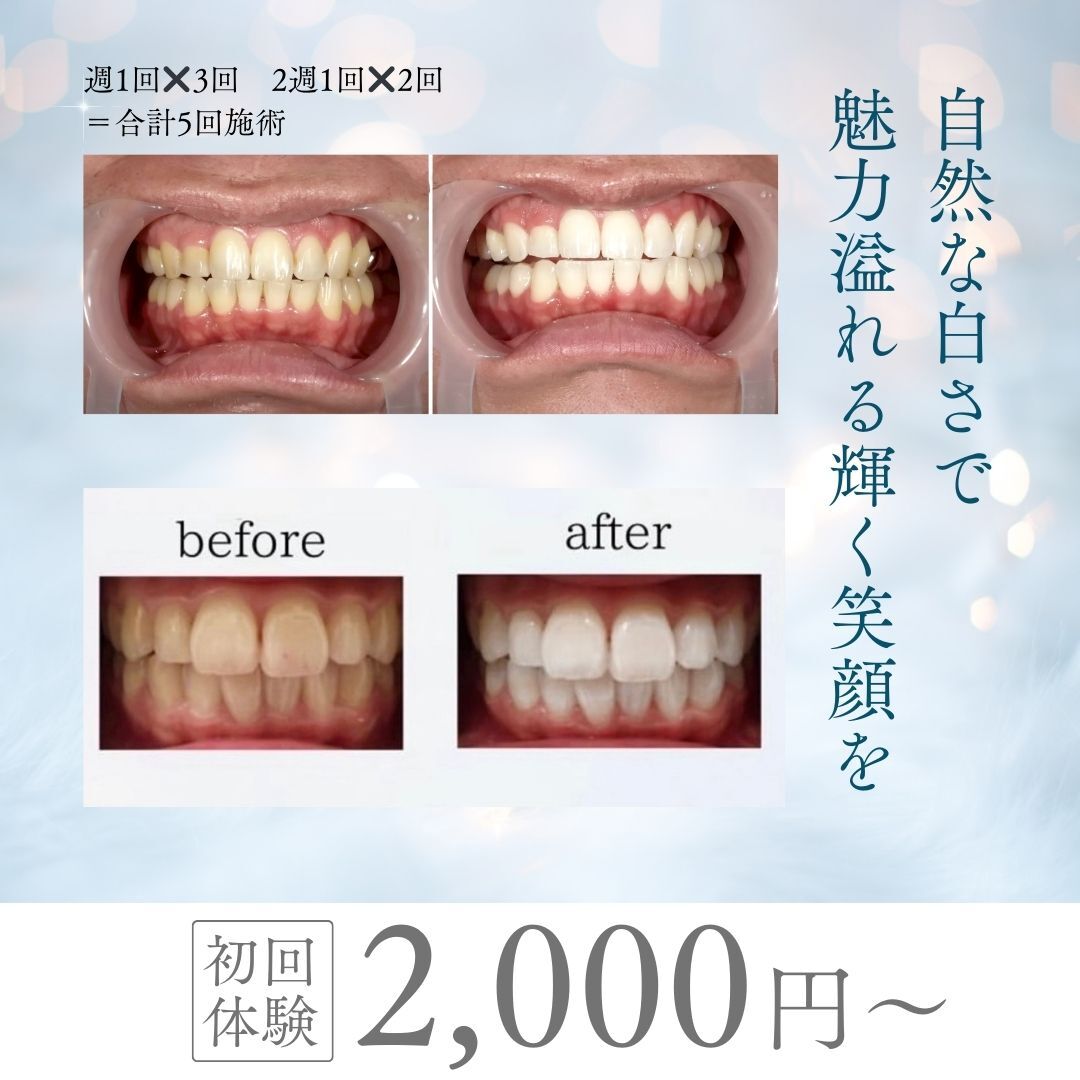 ルミナ(LUMINA)｜ホットペッパービューティー