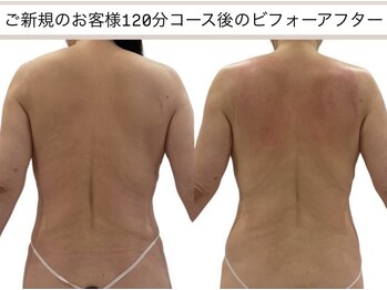 オリーブ(Olive)の写真/脂肪燃焼徹底サポート♪温活×もみほぐしで浮腫みや老廃物の排出を促進☆代謝UPで理想の美Bodyを導きます！