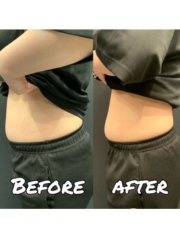 ビーライフ(BE LIFE)/20代女性3ヶ月体重9キロ減