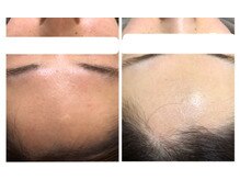 オアジスパ(Oasi Spa)/ＤＴありハーブ３回