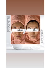 カフネ(CAFUNE.)/美白メニュー