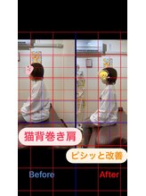 ヒデ整体院(Hide整体院)/猫背矯正骨盤矯正B/A肩こり腰痛