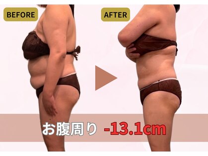 リベル(Libelle)の写真