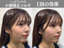 ヘッドミント 南越谷店の雰囲気（小顔矯正コルギ。痛気持ちよくリンパと老廃物を流し小顔へ♪）