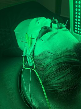 かえで鍼灸整体院/美容鍼×LED照射