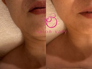 サロンヴェアリー 広尾(salon vary)/首のケアも！！