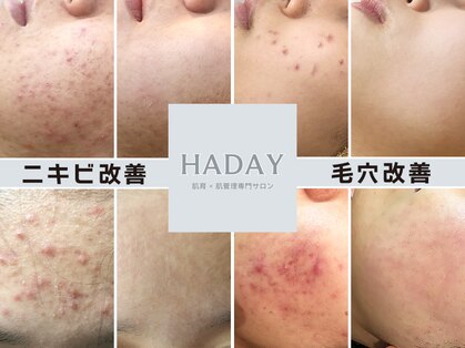 ハダイ(HADAY)の写真