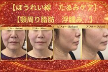 ラシクビューティールーム