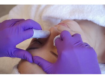 モムケア(momcare)の写真/毛穴の汚れを出す！毛穴が目立つお肌やイチゴ鼻ももう悩まない！毛穴汚れを落としてお肌のもトーンアップ♪