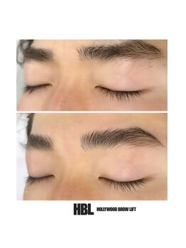 セラス(CERAS)/ハリウッドブロウリフト