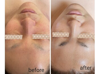 ポノ(pono)/ビフォーアフター