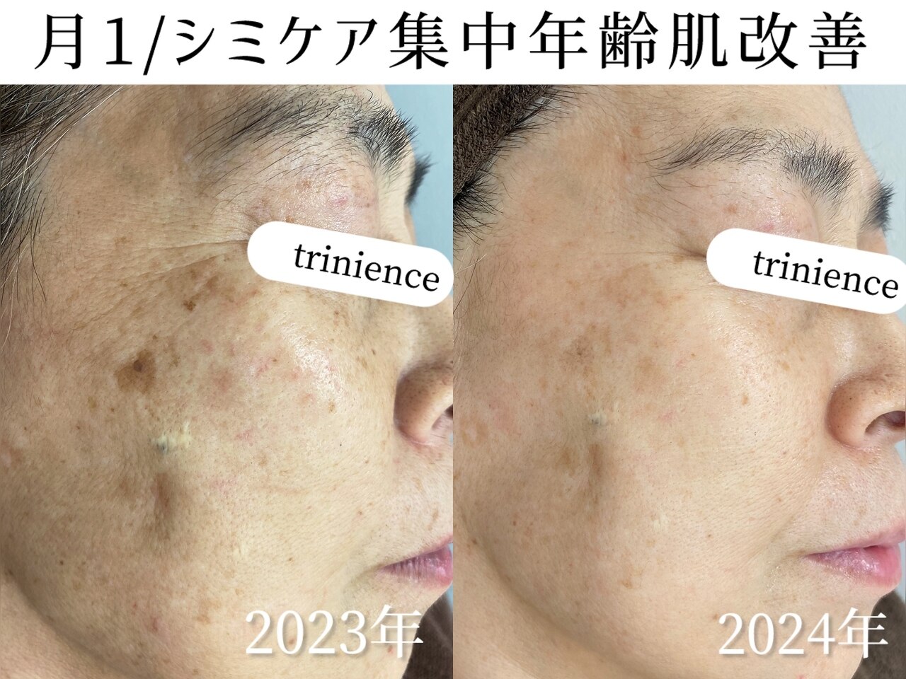 トリニエンス 新宿店(TRINIENCE)｜ホットペッパービューティー