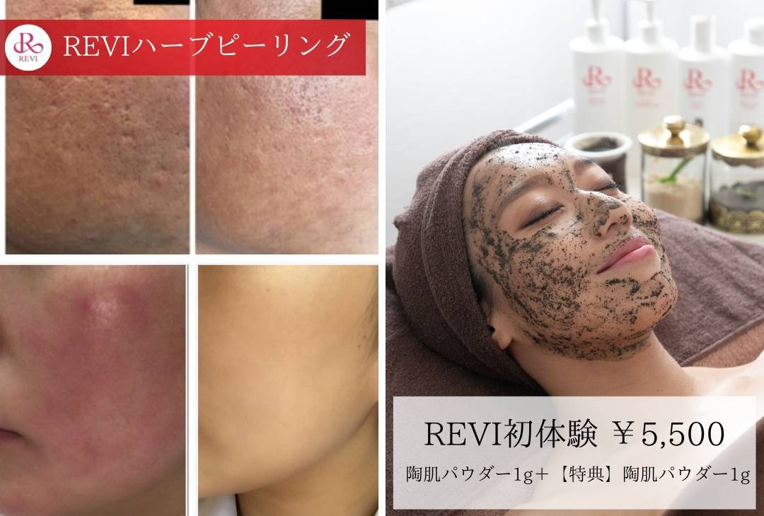 【人気No.1】毛穴・ざらつき・くすみを集中ケアする陶肌ケア