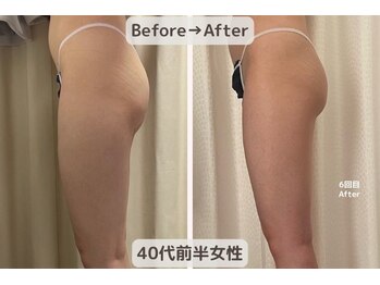 ピーチ(Peach)/骨盤矯正×痩身×リンパ エステ