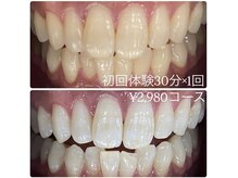 ホワイトニングルーム 横浜店(Whitening Room)/ホワイトニング/横浜