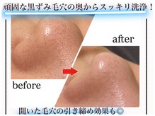 エムイーボーテ(me.Beaute)