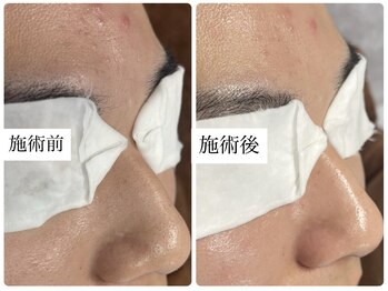 カピリナ(ka pilina)/1回でも実感つる艶肌へ