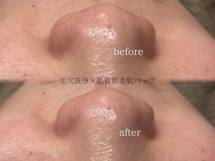 レア(Lea)の写真