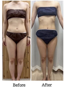 都度払いサロン Clear+ 泡瀬店【クリアプラス】脱毛/フェイシャル/痩身/バストケア/エルフィーノ痩身