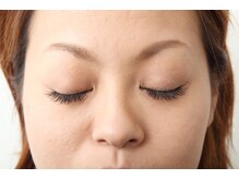 コージープレイスアイビューティー(Cozy Place eye beauty)/after