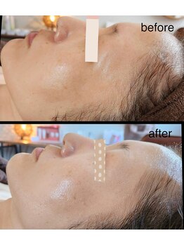 ポノ(pono)/ビフォーアフター