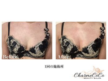 シャルムココ 蔵前店(CharmeCoCo)/お客様Before→After