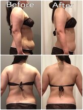 クリスタルビューティー/20回コース