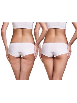 太モモ・ヒップまわりをケアしたい