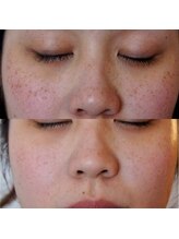 ザ シー タイムレスビューティ(THE SHE)/20代お客様症例写真