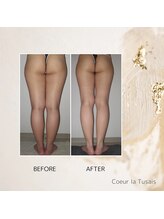 クーラ テュセ(Coeur la Tusais)/下半身集中痩身