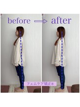 稲川鍼灸接骨院/フェムケア矯正