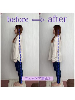 稲川鍼灸接骨院/フェムケア矯正