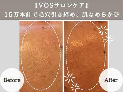 アンジュ(ANGE)の写真