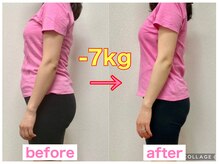 骨盤整体 サクラ(Sakura)/ビフォーアフター/妊婦産後骨盤